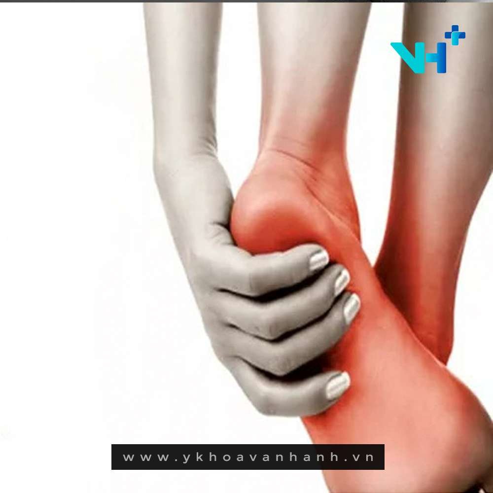 viêm gân bàn chân - nguyên nhân, dấu hiệu và cách điều trị