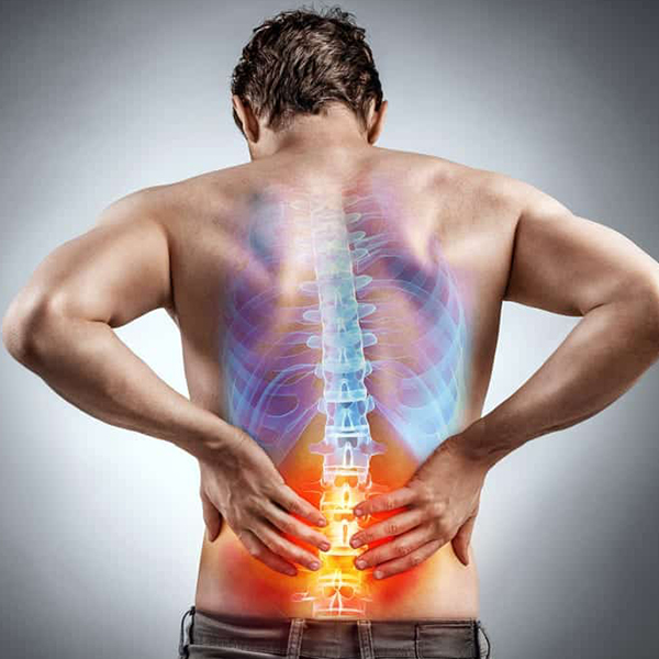 phương pháp điều trị đau thắt lưng là gì? Đau lưng thường thuyên giảm khi nghỉ ngơi, chườm đá và dùng thuốc giảm đau.