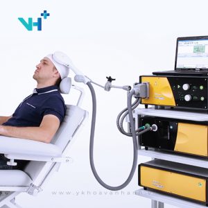 kích thích từ trường xuyên sọ điều trị đau tâm thần kinh