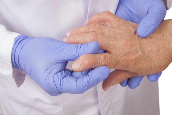 viêm bao hoạt dịch cổ tay - nguyên nhân & triệu chứng