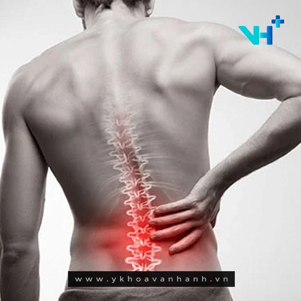 phong bế thần kinh điều trị đau cột sống thắt lưng