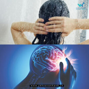 Tại sao đột quỵ thường xảy ra khi tắm?