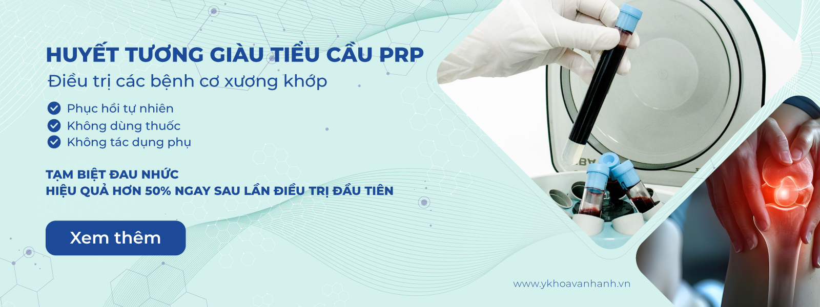 huyết tương giàu tiểu cầu (PRP)