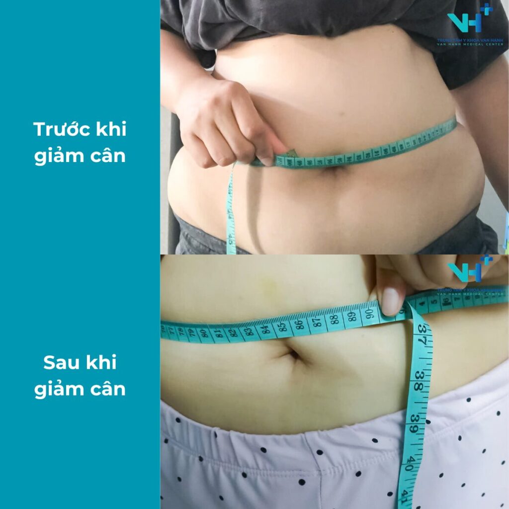 Kết quả sau giảm cân 1