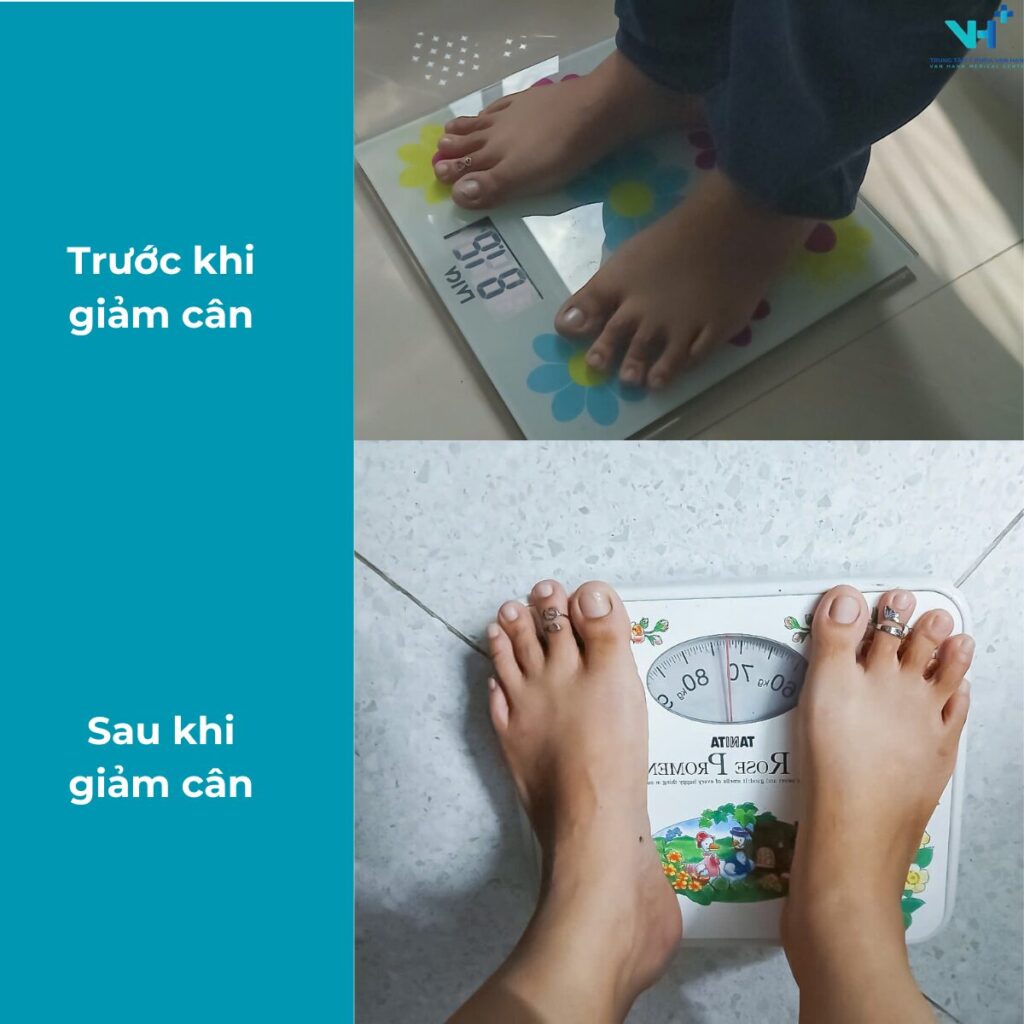 Kết quả sau giảm cân