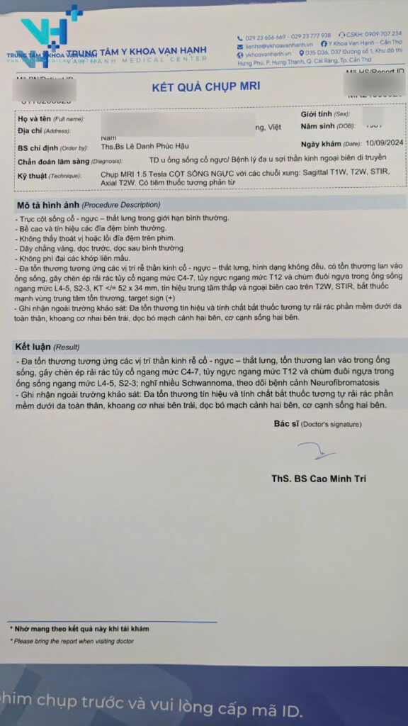 Chẩn đoán chính xác Neurofibromatosis (U xơ thần kinh) nhờ công nghệ MRI hiện đại 1