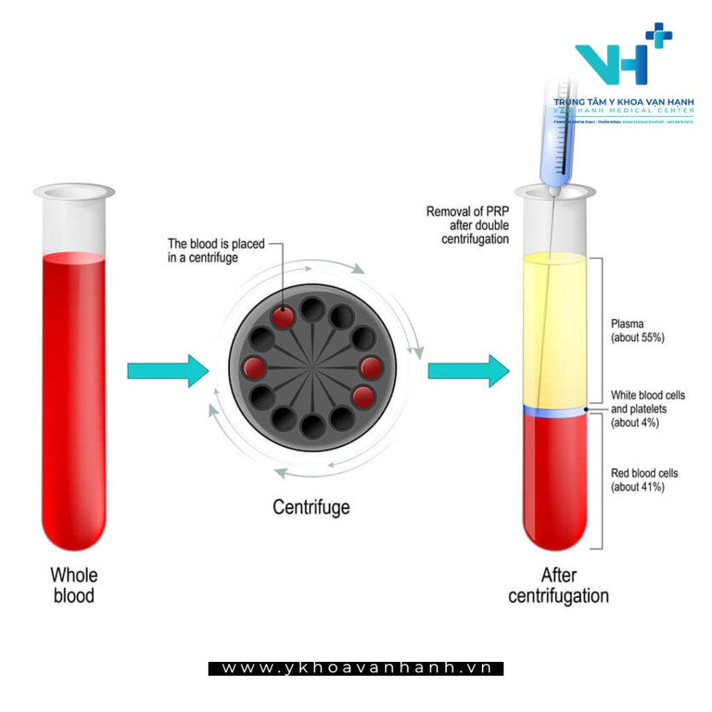 huyết tương giàu tiểu cầu là gì